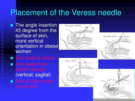 veress needle positioning procedure